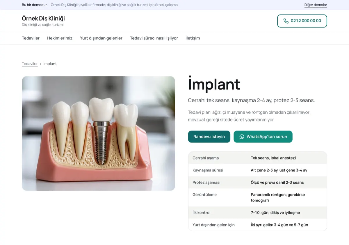 Solda implant modeli fotoğrafı, sağda “İmplant” başlığı ve tablo: cerrahi tek seans, kaynaşma alt çenede 2-3 üst çenede 3-4 ay, protez 2-3 seans.